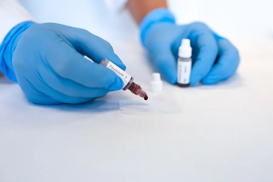 En person med hansker og hansker som holder en sprøyte